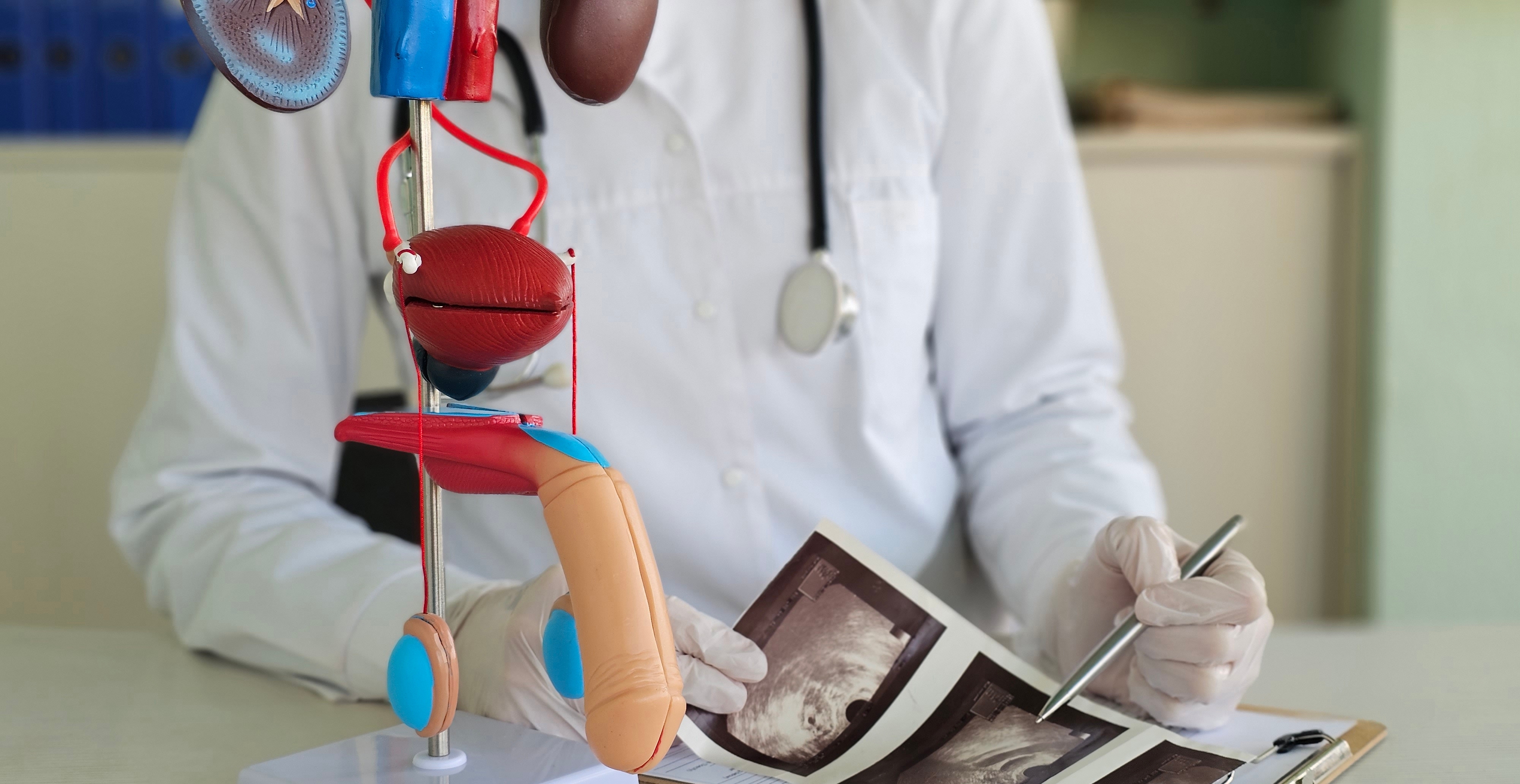 Doctors,Counseling,Patients,With,Prostate,Cancer,And,Using,A,Penis